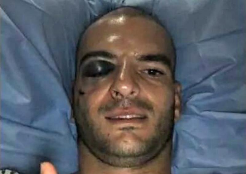 Portero de Lobos BUAP estuvo en riesgo de perder vista de un ojo