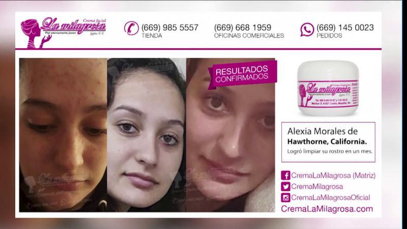 Cofepris alerta por uso de crema La Milagrosa