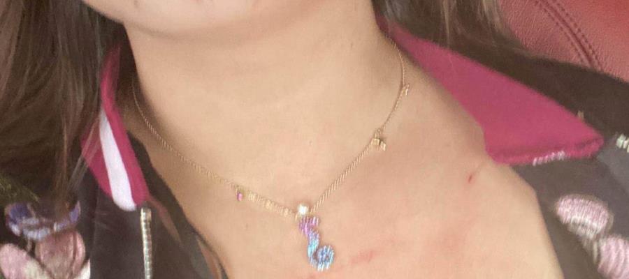 Dan de baja temporal a elementos por golpear al ‘Pollo’ Saldívar y a su esposa Dan de baja temporal a elementos por golpear al ‘Pollo’ Saldívar y a su esposa