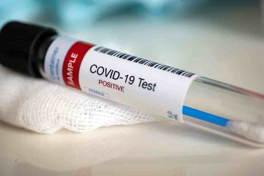 Se esparce Covid hasta Tacotalpa; suman 14 municipios con presencia del virus Se esparce Covid hasta Tacotalpa; suman 14 municipios con presencia del virus