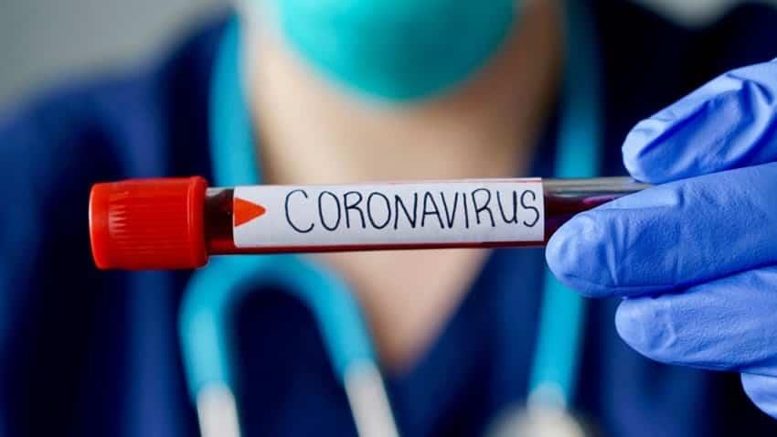 México, último lugar de la OCDE en realizar pruebas de coronavirus: 0.2 por cada 100 mil habitantes