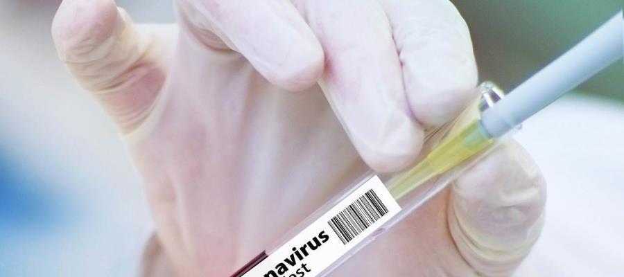 Realiza UNAM pruebas en animales de vacuna contra COVID-19; para 2021 se probaría en humanos