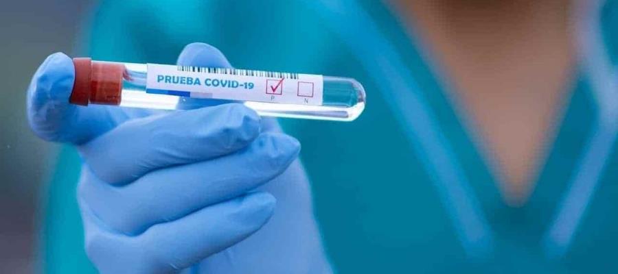 Llega la Liga MX a 30 casos COVID-19 confirmados