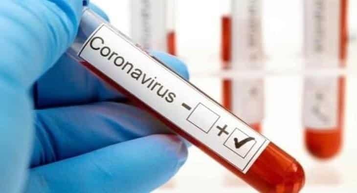 Confirma Pemex 2 mil 183 derechohabientes con covid-19 Confirma Pemex 2 mil 183 derechohabientes con covid-19