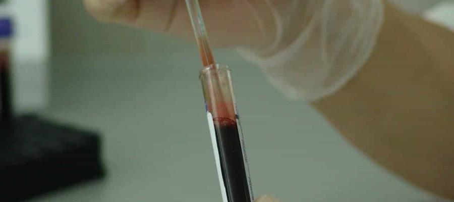 Advierten que el uso de plasma convaleciente contra el Covid-19 aumentaría riesgo de mutaciones Advierten que el uso de plasma convaleciente contra el Covid-19 aumentaría riesgo de mutaciones