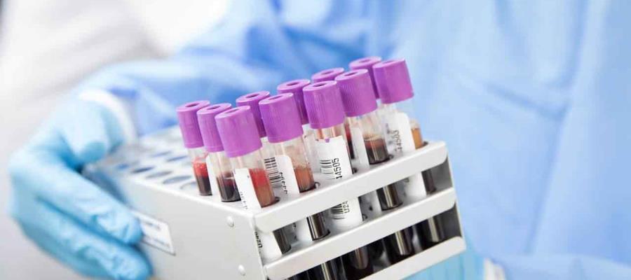 Lanzan en EU primera prueba sanguínea para diagnosticar Alzheimer Lanzan en EU primera prueba sanguínea para diagnosticar Alzheimer