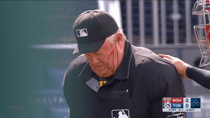 Umpire recibe batazo de pelotero de los Nacionales Umpire recibe batazo de pelotero de los Nacionales
