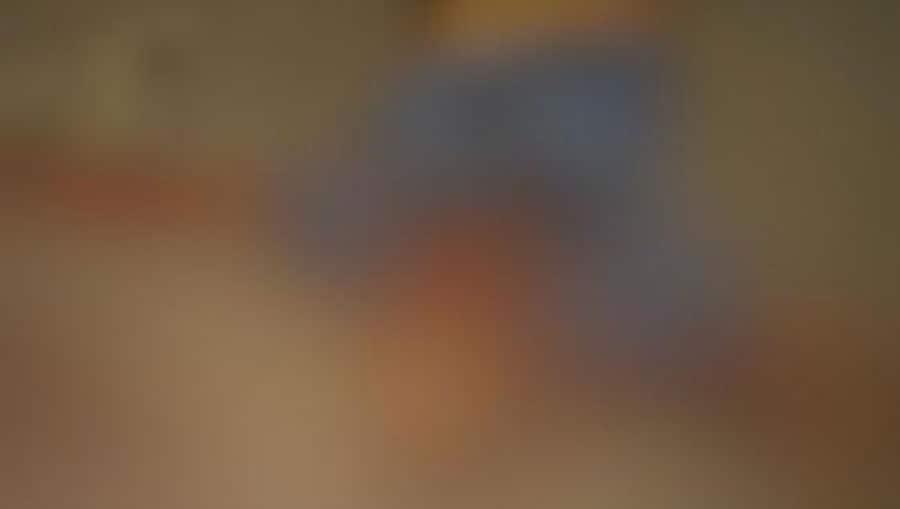 Un muerto y dos heridos deja atropellamiento de motociclistas en la Villahermosa-Frontera