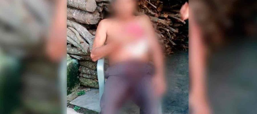 Machetean a sujeto en la ranchería Huimango, Cunduacán