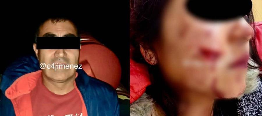 Cortan de la cara a mujer al ser asaltada en la CDMX; detienen a presunto responsable
