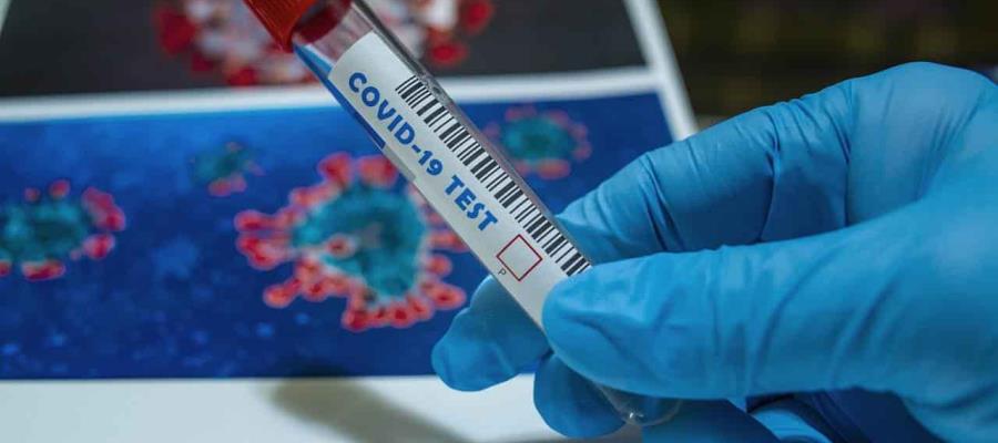 Cierra México el 2020 con más de 1.4 millones de contagios y 125 mil 807 muertes por Covid-19