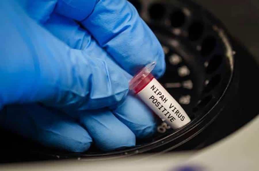 Comunidad Científica de Tailandia preocupada por Nipah, virus que podría ocasionar una nueva pandemia