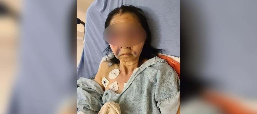 Confunden a abuelita mexicana con asiática y la golpean brutalmente en Los Ángeles Confunden a abuelita mexicana con asiática y la golpean brutalmente en Los Ángeles