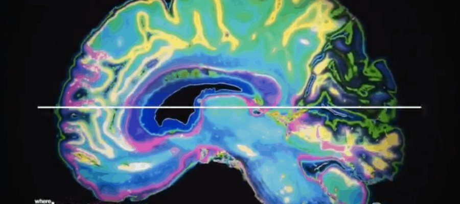 Revela estudio que viajar retrasa aparición de enfermedades cerebrales como el Alzheimer