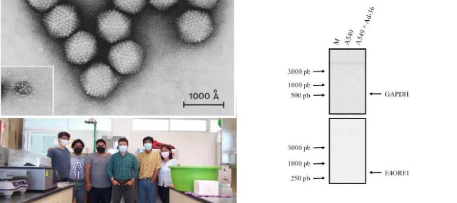 Investigador de la UJAT analiza relación de los virus con la obesidad