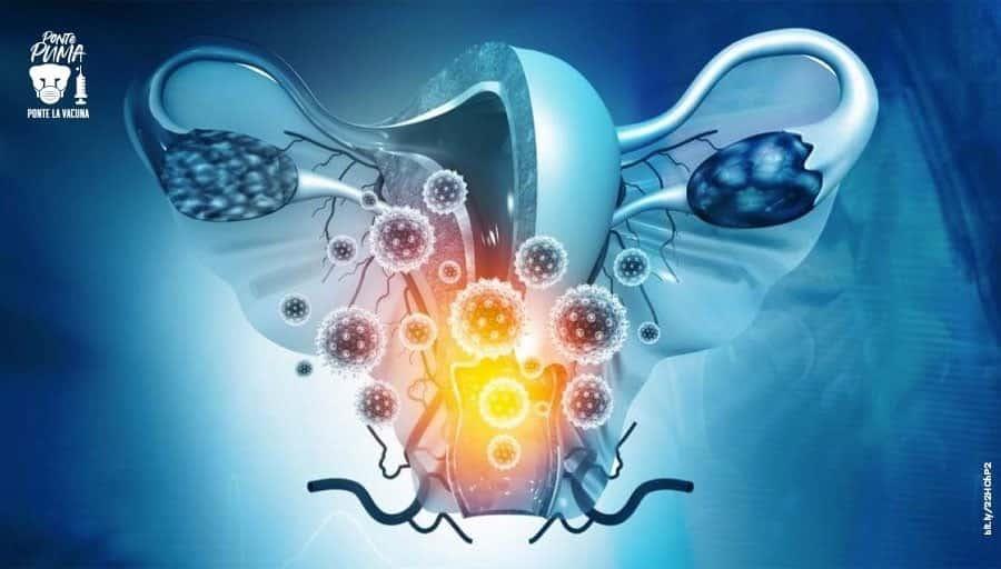 ¿El VPH produce cáncer cervicouterino? Esto descubrieron expertos de la UNAM ¿El VPH produce cáncer cervicouterino? Esto descubrieron expertos de la UNAM