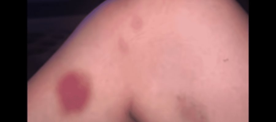 Novia de Mason Greenwood lo denuncia por violencia física Novia de Mason Greenwood lo denuncia por violencia física