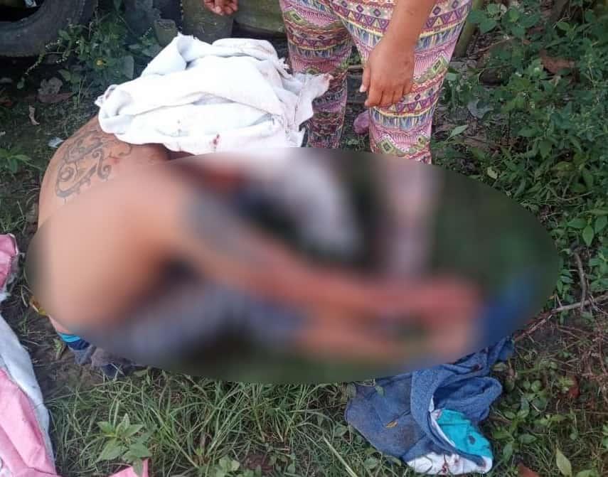 Le amputan mano a hombre en Boquerón