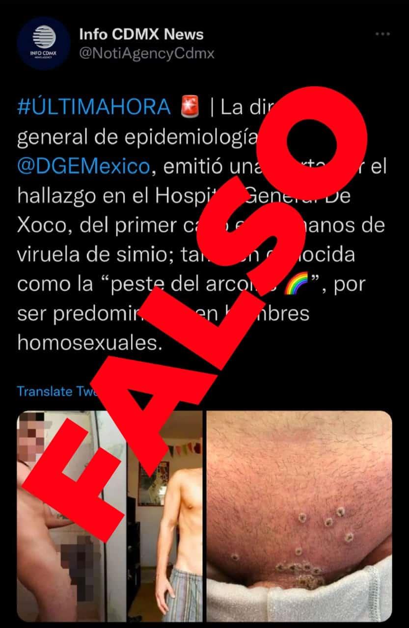 Desmiente Secretaría de Salud supuesto caso de viruela del mono en México