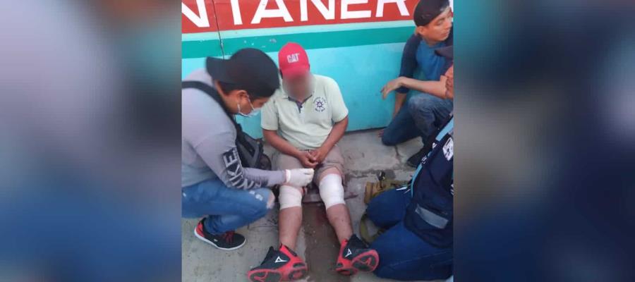 Le disparan en las piernas y le quitan su moto en Cárdenas Le disparan en las piernas y le quitan su moto en Cárdenas