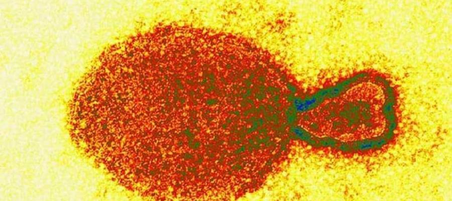 Detectan ahora en China el Henipavirus, es de origen animal; hay 35 contagiados Detectan ahora en China el Henipavirus, es de origen animal; hay 35 contagiados
