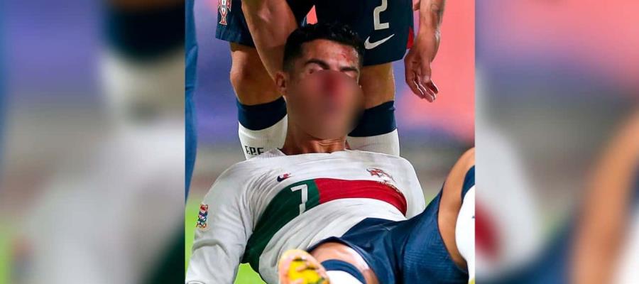 CR7 recibe duro golpe en la cara frente a República Checa