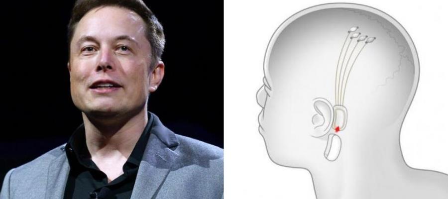 Neuralink, compañía de Elon Musk, colocaría implante cerebral a mediados de 2023 Neuralink, compañía de Elon Musk, colocaría implante cerebral a mediados de 2023