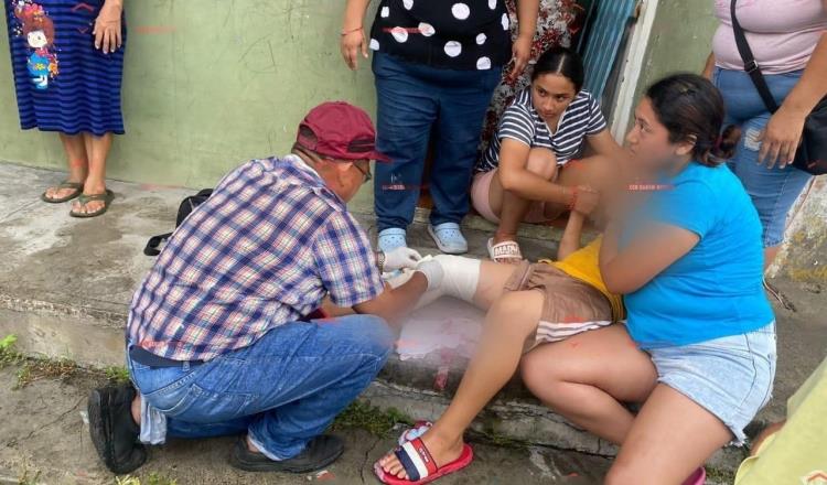 Niño cae debajo de autobús abandonado en Cárdenas y resulta herido de su pierna