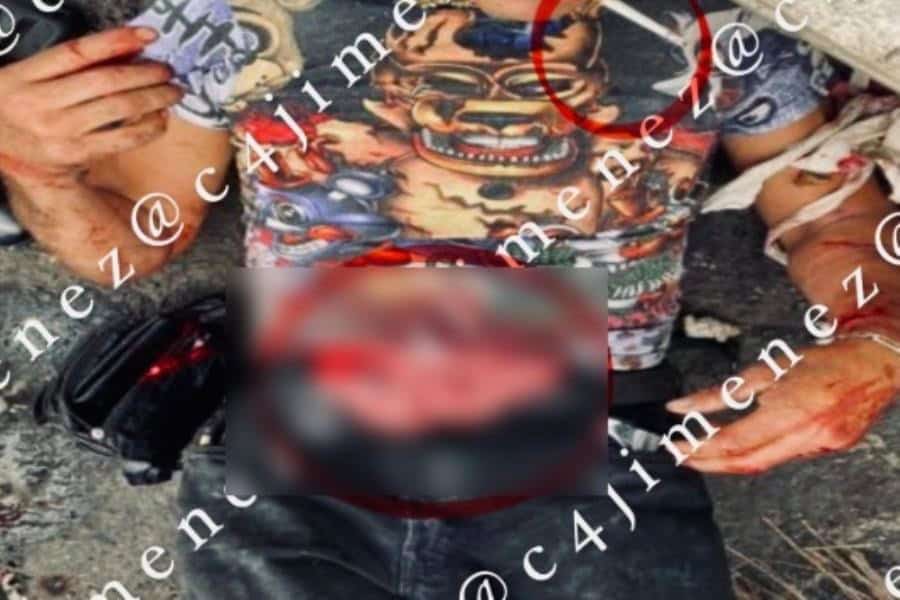Apuñalan a franelero en CDMX; espera ambulancia fumando y con intestinos expuestos