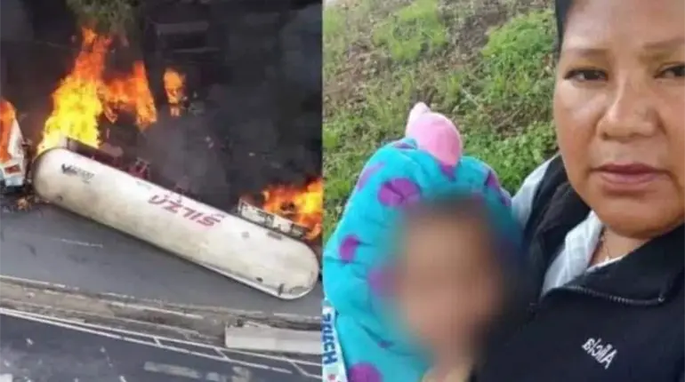 Jazlyn, menor sobreviviente a explosión de pipa en Iztapalapa, recibe primera cirugía de injertos