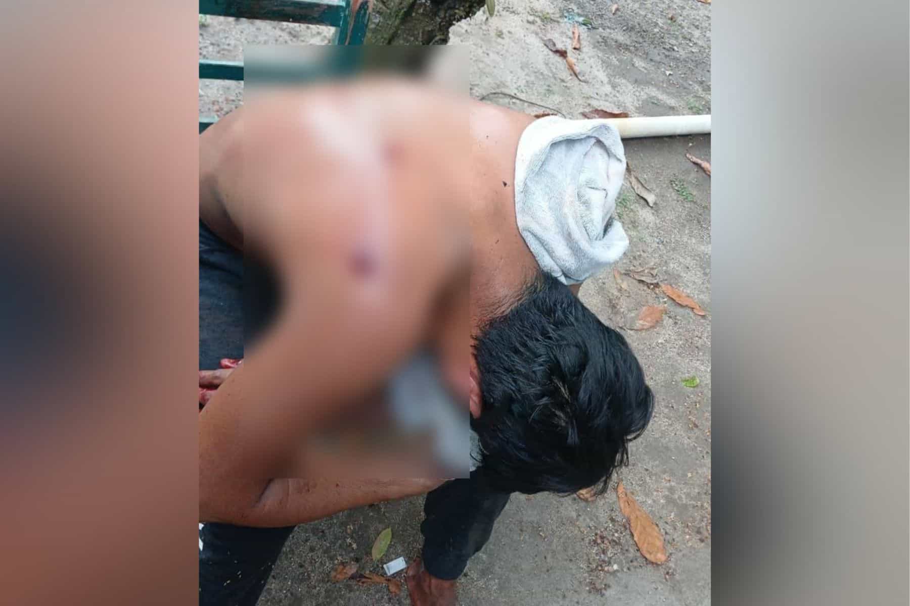 Sujeto resulta herido de bala en Comalcalco