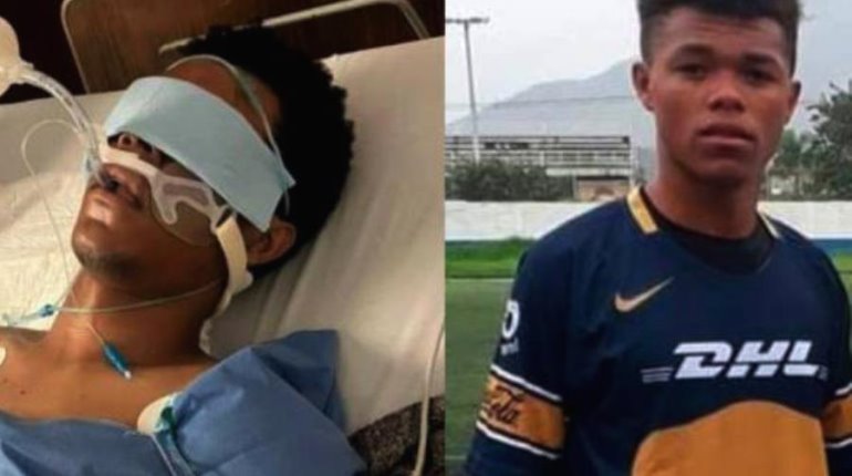 Jugador colombiano queda en coma tras recibir golpiza por celebrar gol en partido amateur en Texcoco