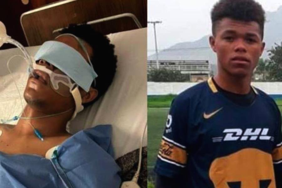 Jugador colombiano queda en coma tras recibir golpiza por celebrar gol en partido amateur en Texcoco