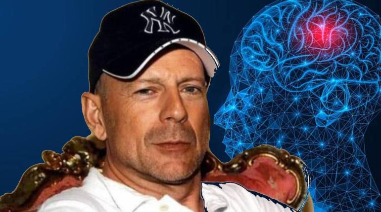 Ventilan que Bruce Willis habría perdido capacidad de comunicarse por demencia frontotemporal