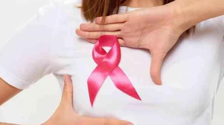 Hasta 170 casos anuales de cáncer de mama se detectan en Tabasco: Salud