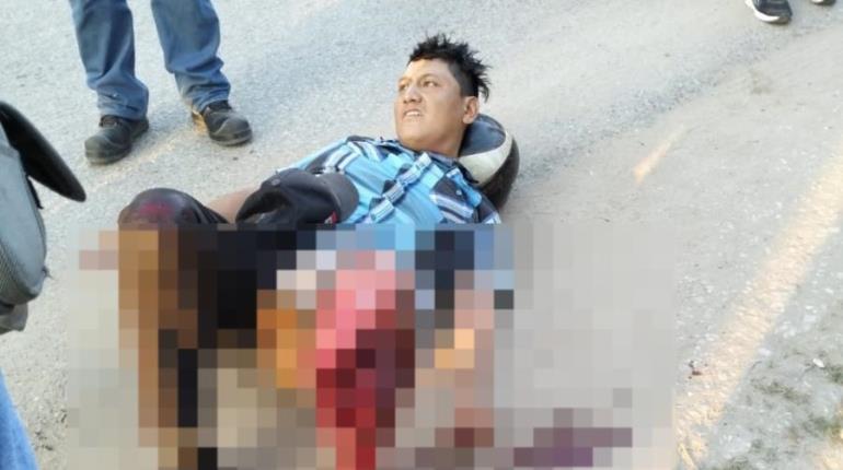 Tras fuerte choque, motociclista queda gravemente herido en la Villahermosa – La Isla