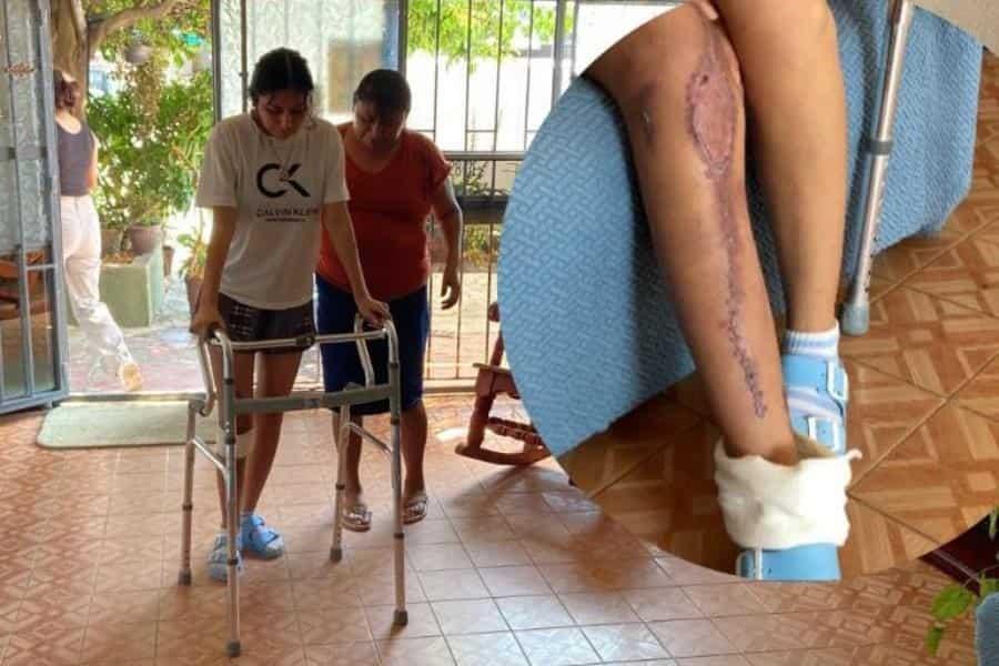 Salvan pierna de joven con servicio social de Telereportaje