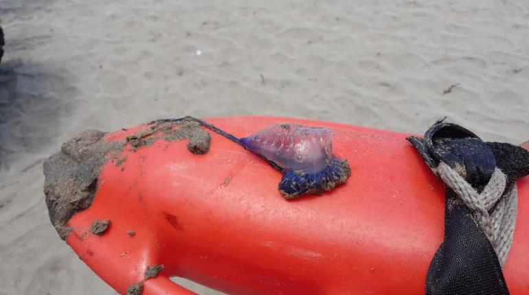 Medusa ataca a niño en playas de Paraíso