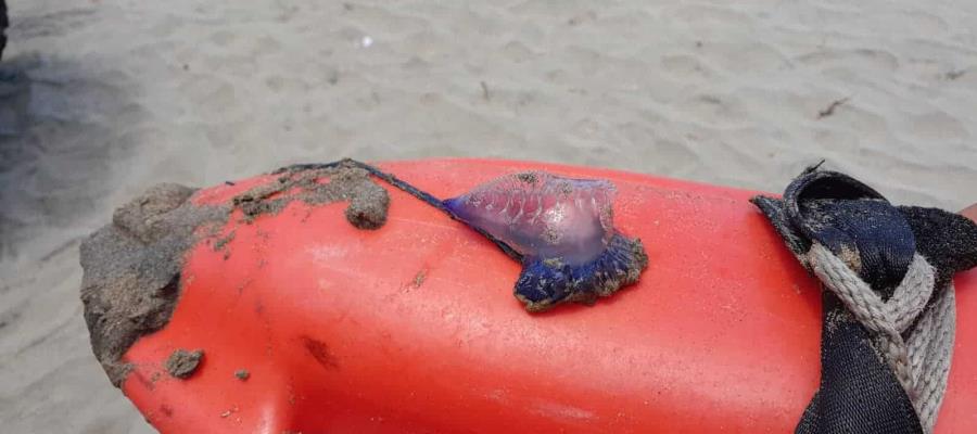 Medusa ataca a niño en playas de Paraíso