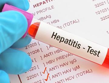 Alertan por brote de hepatitis en San Cristóbal de las Casas, Chiapas