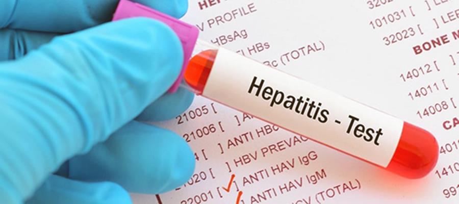 Alertan por brote de hepatitis en San Cristóbal de las Casas, Chiapas