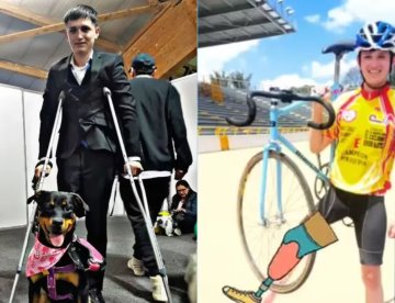 Ángel perdió una de sus piernas por negligencia médica tras ser hospitalizado por salvar a su perrita de un accidente