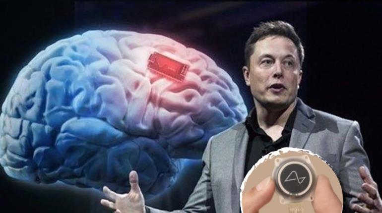 Neuralink, de Elon Musk, ya busca segundo paciente para implantar chip cerebral