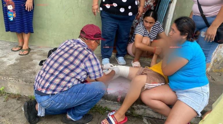 Niño cae debajo de autobús abandonado en Cárdenas y resulta herido de su pierna