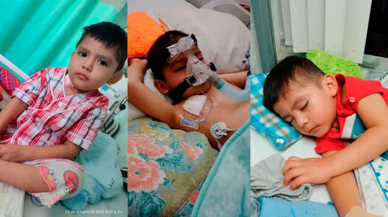 ¡Leo no se rinde!, niño de 5 años lucha contra la leucemia; familia busca recursos