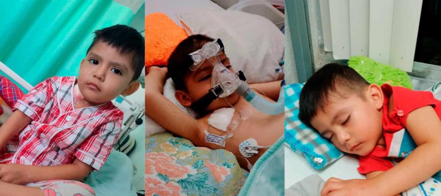 ¡Leo no se rinde!, niño de 5 años lucha contra la leucemia; familia busca recursos