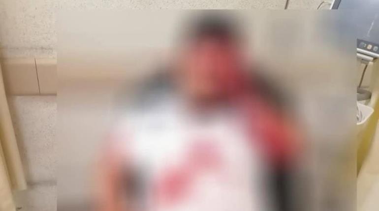 Atentado a balazos frente a Iglesia de Guatacalca empaña festejo Guadalupano