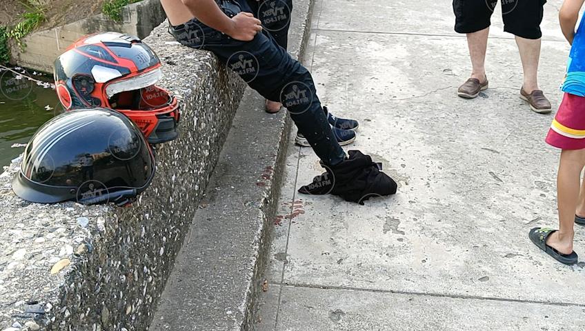 ¡Un caso más! Joven es mordido por cocodrilo mientras se bañaba en el Vaso Cencali ¡Un caso más! Joven es mordido por cocodrilo mientras se bañaba en el Vaso Cencali