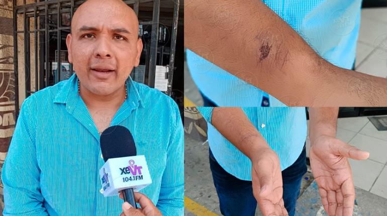Ciudadano denuncia abuso de autoridad y haber sido golpeado por elementos de la SSPC