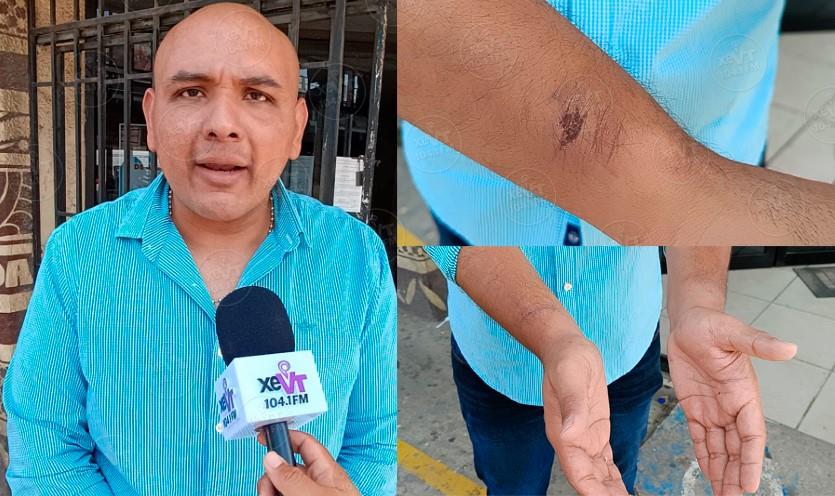 Ciudadano denuncia abuso de autoridad y haber sido golpeado por elementos de la SSPC Ciudadano denuncia abuso de autoridad y haber sido golpeado por elementos de la SSPC